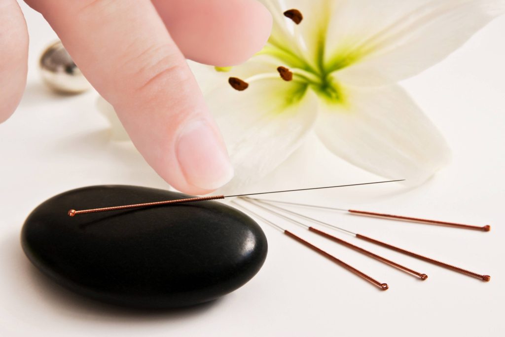 کلینیک طب سوزنی دکتر کی‌نوش همایونی