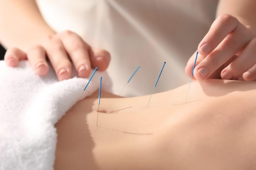 طب سوزنی دیسک کمر دکتر کی‌نوش همایونی